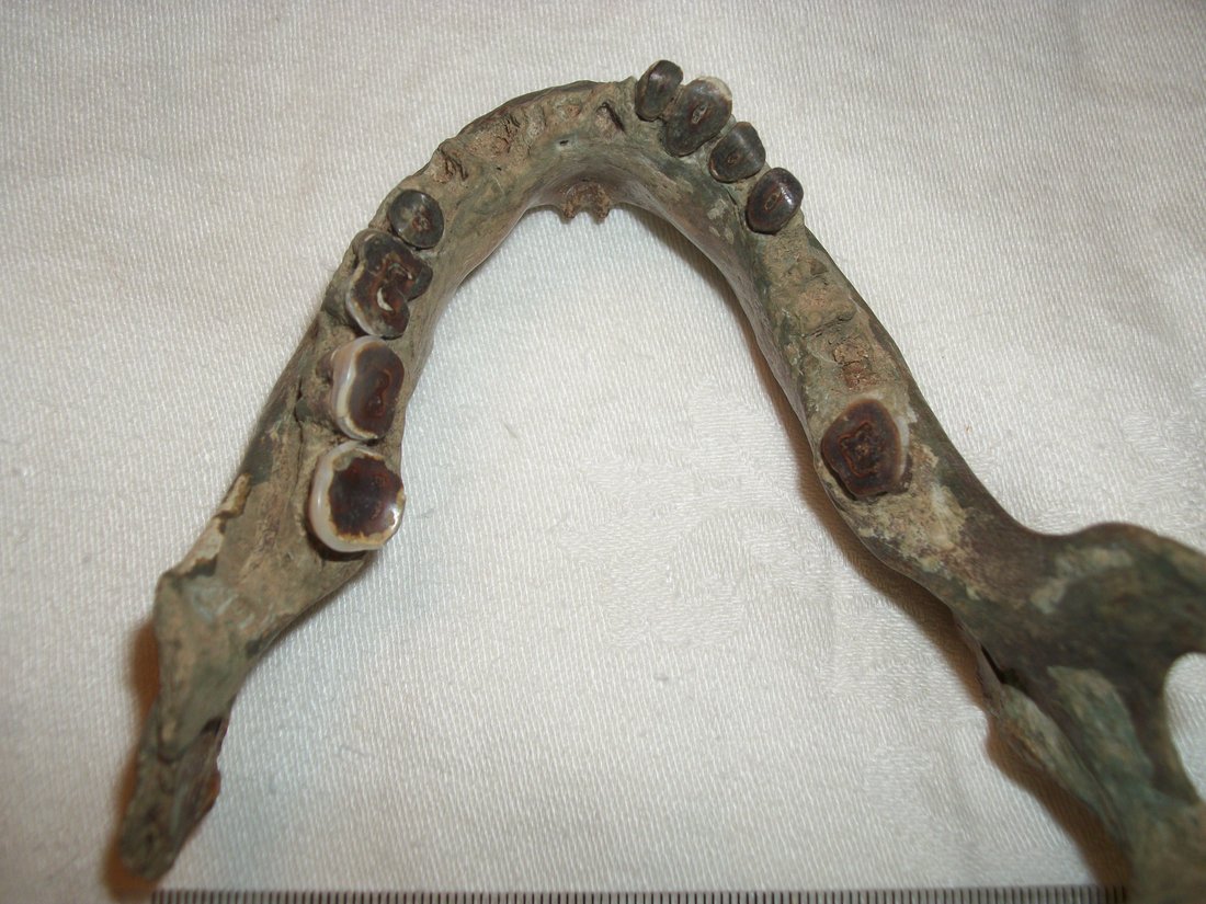 width rear inferior maxillary 11.5 centimeters
vertical height 7.2 centimeters